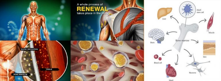 terapi stem cell di Indonesia